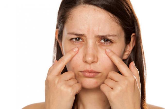 كيفية التخلص من كدمات تحت العين لمدة 10 دقيقة؟