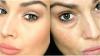 5 وصفات قديمة للمساعدة في جعل طازجة الشكل ومرونة الجلد حول العينين والشباب