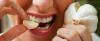 7 طرق كيفية التخلص من رائحة الفم الثوم