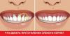 كيفية علاج اللثة عندما تصبح الأسنان العارية الرقبة؟